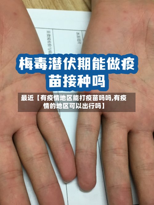 最近【有疫情地区能打疫苗吗吗,有疫情的地区可以出行吗】-第3张图片