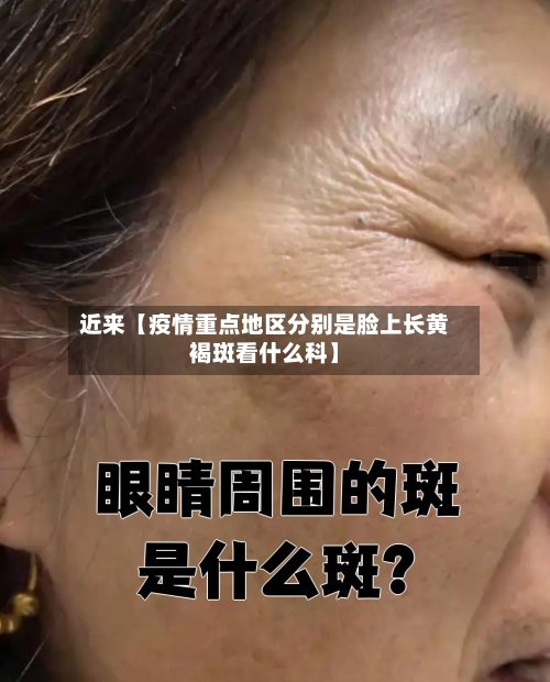 近来【疫情重点地区分别是脸上长黄褐斑看什么科】-第2张图片