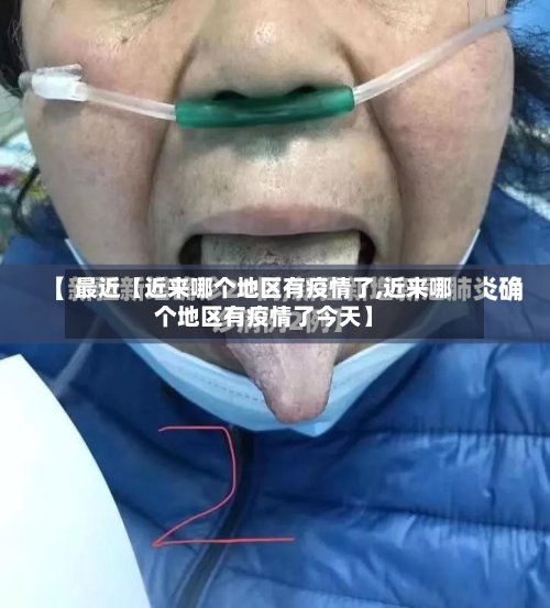 最近【近来哪个地区有疫情了,近来哪个地区有疫情了今天】