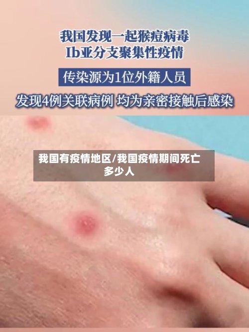 我国有疫情地区/我国疫情期间死亡多少人