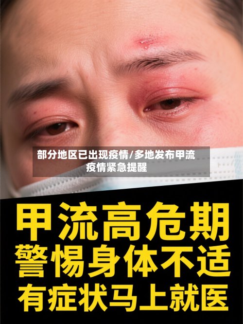 部分地区已出现疫情/多地发布甲流疫情紧急提醒-第2张图片